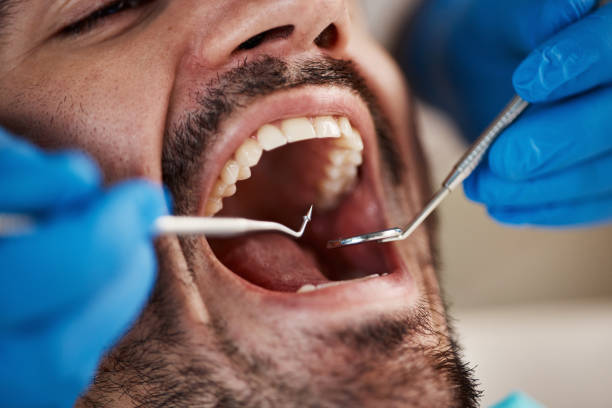 Best Emergency Denture Repair in Camp Swift, TX